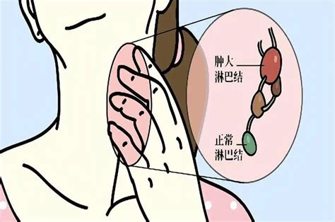 化疗8次，多处转移 还是中医好成都普济中医肿瘤医院杨成平 知乎