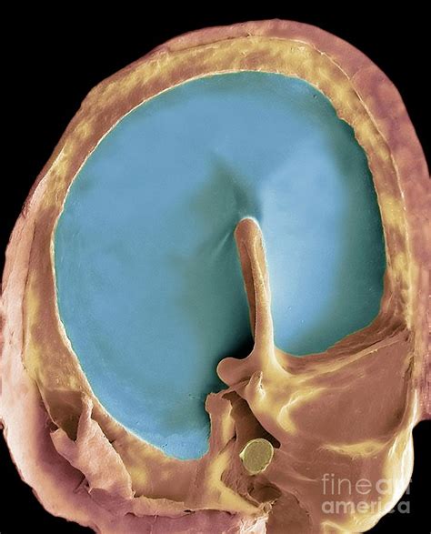 eardrum photograph  steve gschmeissnerscience photo library pixels