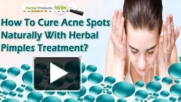 Ppt How To Cure Acne Spots Naturally With Herbal Pimples Treatment