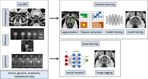 Machine Learning Applications In Prostate Cancer Magnetic Resonance