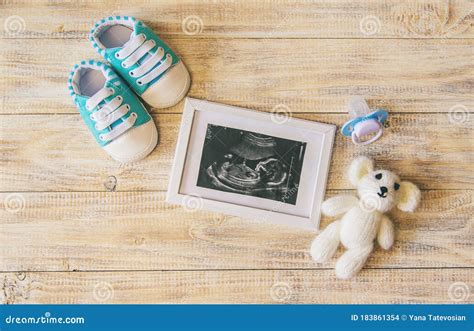 Imagen De Ultrasonido De Una Fotograf A Y Accesorios Para Ni Os Foco