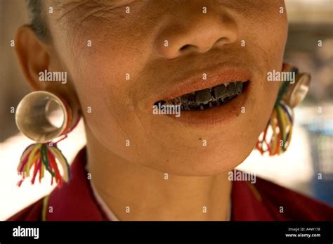 Teeth Betel Nut Chewer Hi Res Stock Photography And Images Alamy