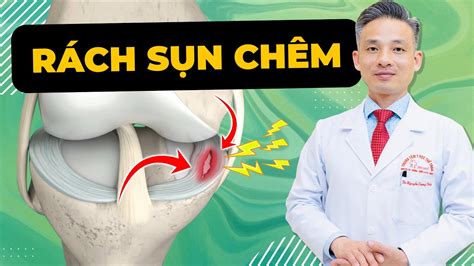 Nhận Biết RÁch SỤn ChÊm Và Cách Điều Trị RÁch SỤn ChÊm Bác Sĩ Thể Thao Nguyễn Trọng Thuỷ Youtube