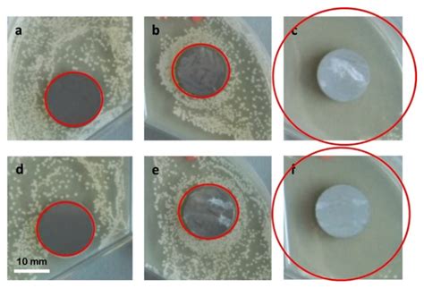 Coatings Free Full Text Biopolymers For Surgical Applications