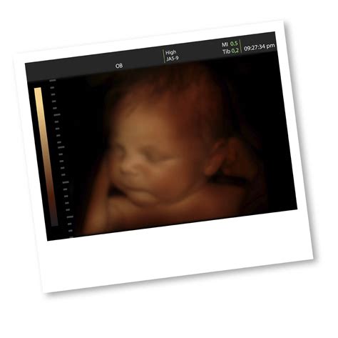 3d And 4d Ultrasounds During Pregnancy