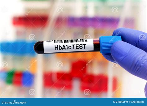 Amostra De Sangue Para O Estudo Da Hba1c Ou Da Hemoglobina A1c Para