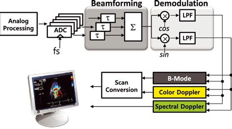 Ultrasound Machine Diagram