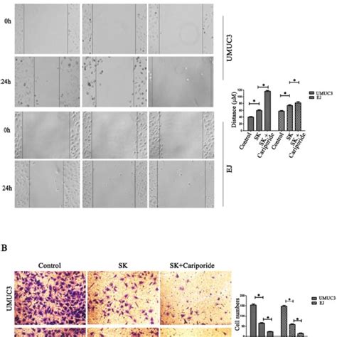 SK Inhibits Migration And Invasion Of Bladder Cancer Cells A Effects