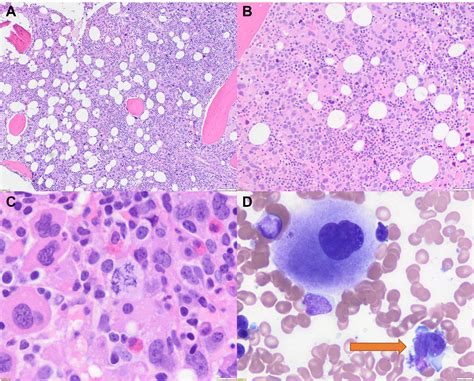 Fifth Edition Of The World Health Classification Of Tumors Of The