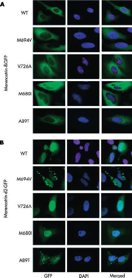 Subcellular Localisation Of Wild Type Or Mutated M P Fl And D In Hela