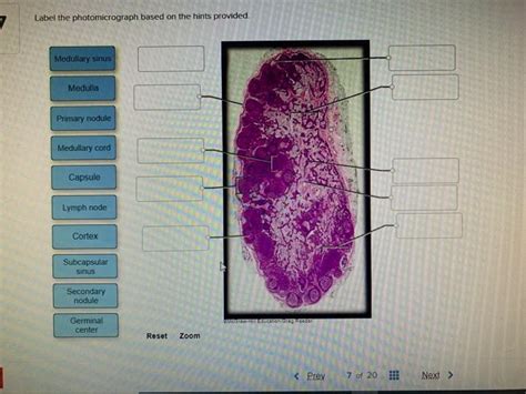 Solved Label The Photomicrograph Based On The Hints Chegg