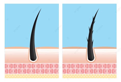 모발 관리 혈청 모낭 진단 주형 여자 성장 Png 일러스트 및 벡터 에 대한 무료 다운로드 Pngtree 케라틴