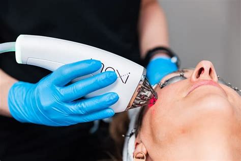 Bblmoxi™ Laser Facial Achieve Radiant Skin In Naperville Il