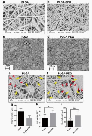 Plga Peg、plga纳米纤维对人神经sh Sy5y细胞的突触效应比较支架