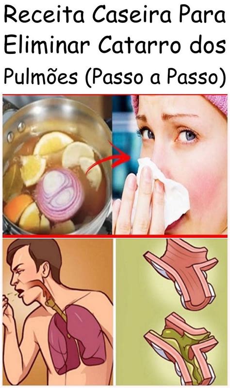 Pin Em Sa De Dicas E Receitas Caseiras