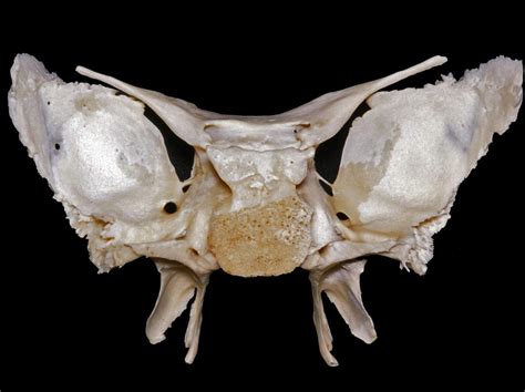 Posterior View Of The Sphenoid Bone Neuroanatomy The Neurosurgical