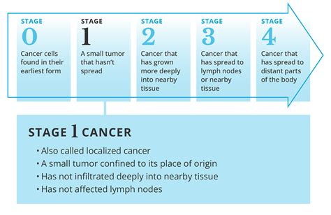 What Is Stage 1 Cancer and How Is It Treated? | City of Hope