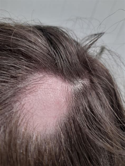 Does there look like there's regrowth in these spots? I really hate