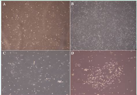 Primary In Vitro Culture Of Bm Mscs And Ad Mscs Adherent Mesenchymal Download Scientific