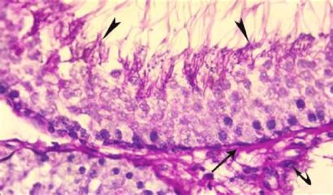 A Photomicrograph Of A Section In The Testis Of A Control Rat Showing Download Scientific