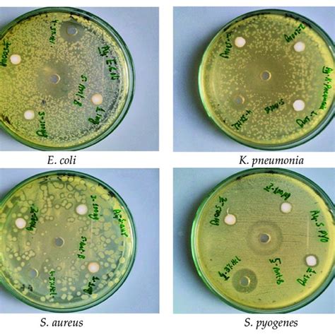 Zone Of Inhibition Zoi Formed By Zno Against Different Bacteria