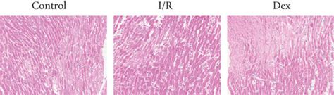 Myocardial Infarct Size And Cardiomyocyte Apoptosis In I R Rats A