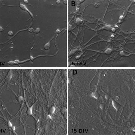 Morphological development of cortical neurons in dissociated cell... | Download Scientific Diagram