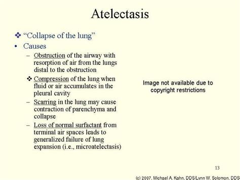 Atelectasis Vs Pneumothorax In Nclex Nursing School Nclex Review