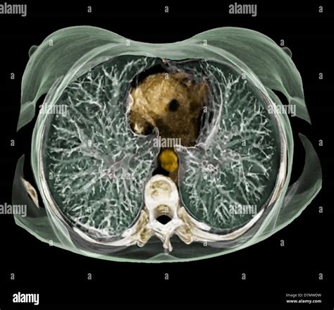 Chest anatomy, 3D CT scan Stock Photo - Alamy