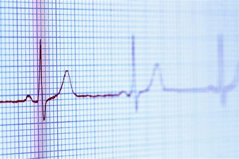 Electrocardiogram Purposes And Types Of Ekgs Us News