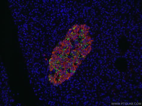 Somatostatin Aa Antibody Ap Proteintech