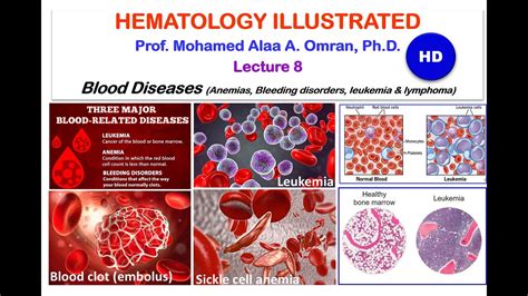 Hematology Lecture 8 2020 Hd Youtube