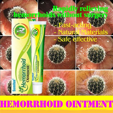 【amazing Effect】hemorrhoids Ointment Treatment Gamot Sa Almoranas Hemorrhoids Cream Herbal