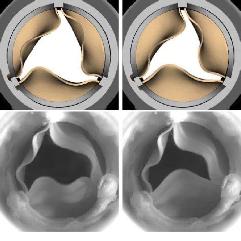 A Model Porcine Bioprosthetic Valve Geometry And Fiber Architecture