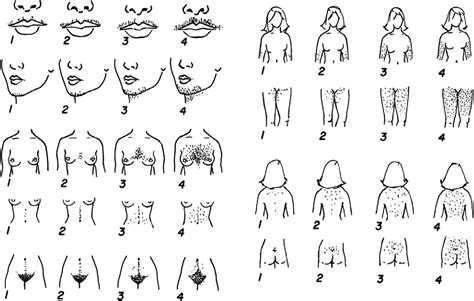 Hirsutism