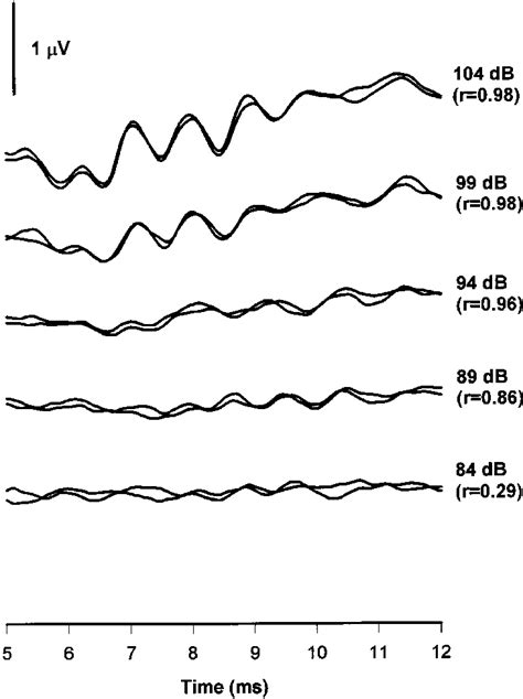 Auditory Brainstem Response Abr Waveforms Of Trichogaster Download Scientific Diagram