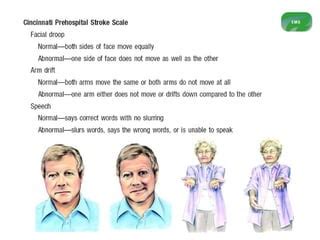 Aha Asa Guidelines For Ischemic Stroke Ppt