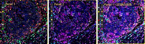 多重荧光多色荧光免疫组化图像分析 知乎