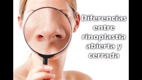 RinoplastÍa Abierta Vs Cerrada 👃 Cuáles Son Las Diferencias😍 Dr Percy