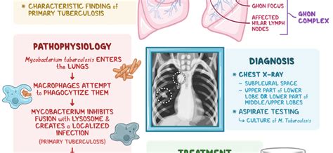 Primary tuberculosis – causes, symptoms, treatment. Types of post ...