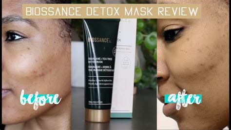 Best Acne Face Mask Biossance Squalane Tea Tree Detox Mask Review