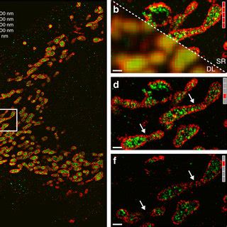 Dna Paint Imaging Of Distinct Types Of Biomolecular Targets At Single