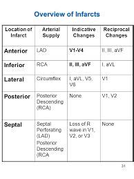reciprocal  ekg eastsadeba