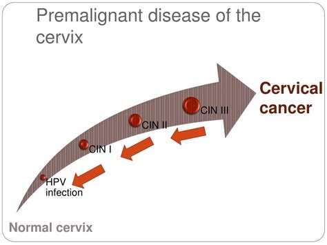 Ppt Benign And Premalignant Disease Of The Cervix Powerpoint