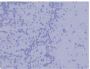 Lab 3 Aseptic Technique Smear Prep And Simple Stain Flashcards Quizlet