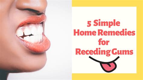 5 Simple Home Remedies For Receding Gums Youtube