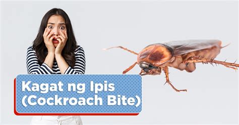 Kagat Ng Ipis Cockroach Bite Mediko Ph