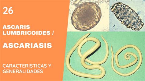 Ascaris Lumbricoides Ascariasis Nematodos Youtube