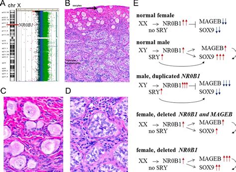 Female To Male Sex Reversal Associated With Unique Xp212 Deletion