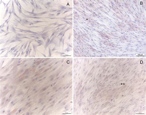 Immunhistochemical Staining Against β Catenin In Fibroblasts After 8